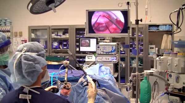 Дивертикулы пищевода