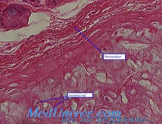 перихондрит гортани