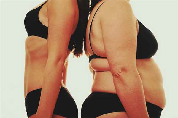 Синдром Иценко-Кушинга