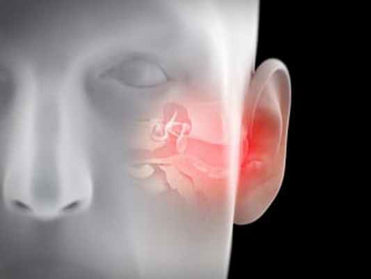 Вестибулярная шваннома