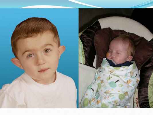 Презентация - Синдром CHARGE (Холла-Хитнера)