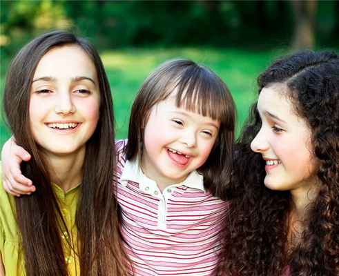 Синдром дауна (монголизм)