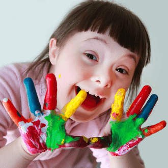 Синдром Дауна