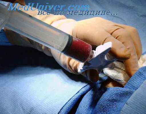 синдром длительного сдавливания