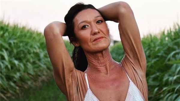 26-летняя Сара Гертс, модель и инфлюенсер с синдромом Элерса — Данлоса