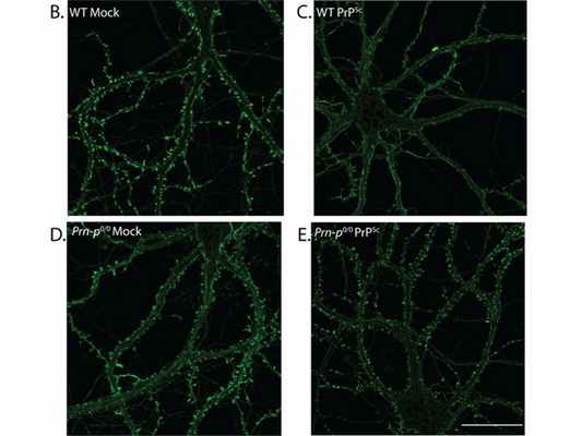 Уменьшение числа дендритных шипиков при прионной инфекции