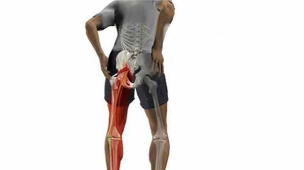 Синдром грушевидной мышцы