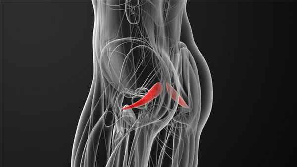 Синдром грушевидной мышцы