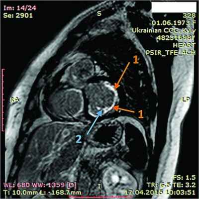Рис7Без имени-1