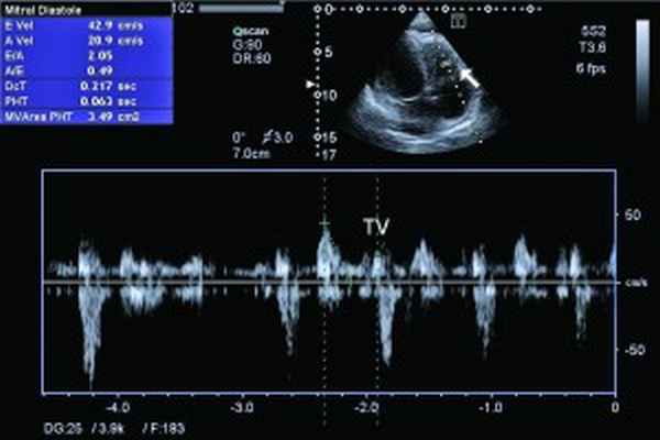 Рис5Без имени-1