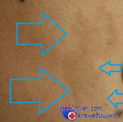 пятна кофе с молоком