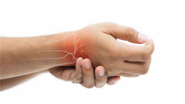 Синдром запястного канала