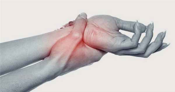 Синдром запястного канала: диагностика и лечение в Ярославле