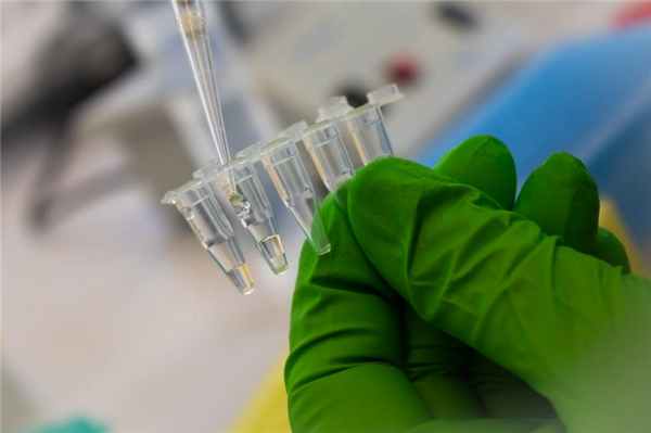 Синдром Жильбера