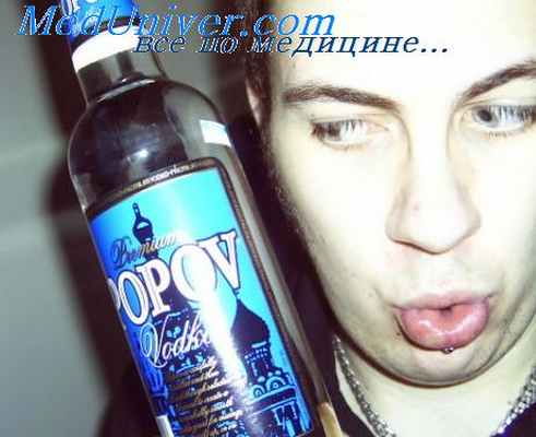 синдромы алкоголизма