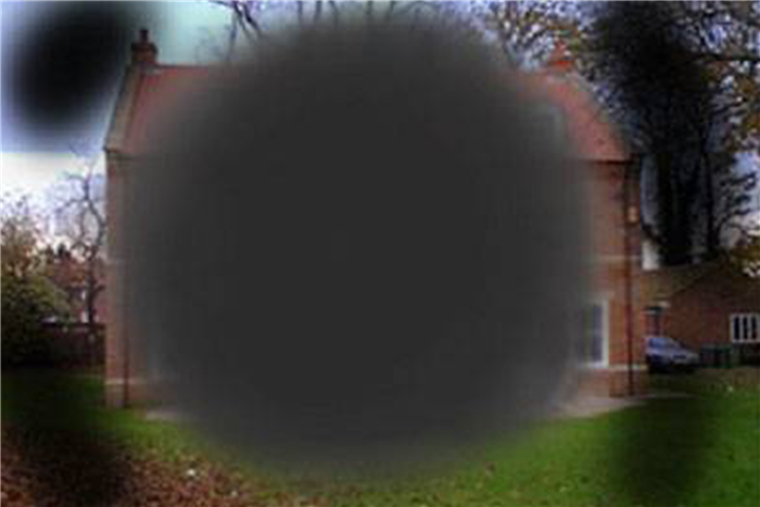 Что такое дистрофия сетчатки