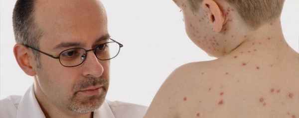 сыпь у ребенка