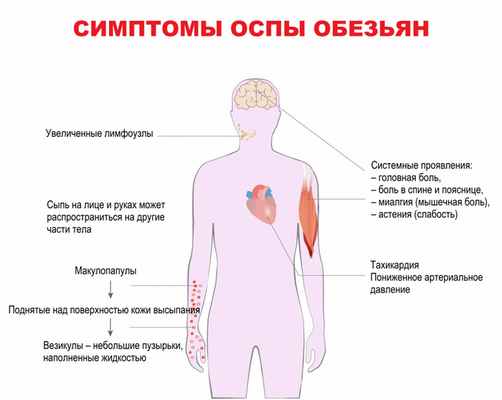 Симптомы.jpg
