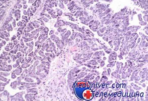 антигены опухолей