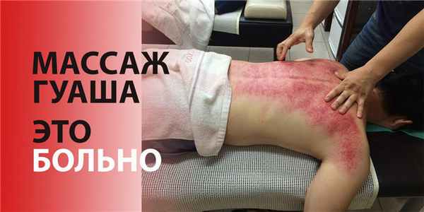Массаж Гуаша это больно