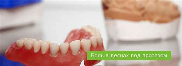 Что делать, если болит и воспаляется десна под протезом?