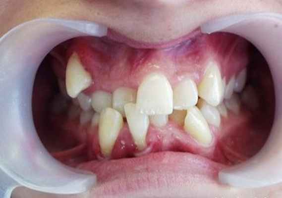 4b29798f454a7d01bd72b2775620d498