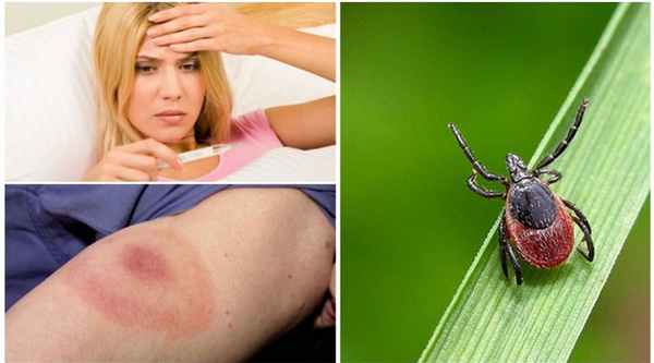 borrelioz_1.jpg