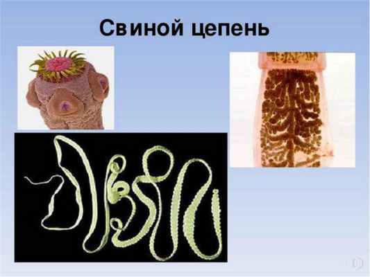 Паразиты в мозгу: возможные причины возникновения, симптомы, методы терапии
