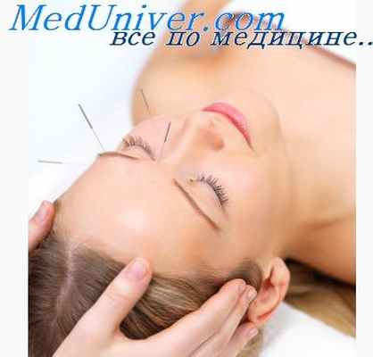 акупунктура полиневропатии