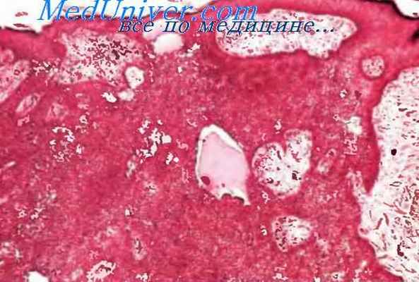 гистология эккриновой поромы