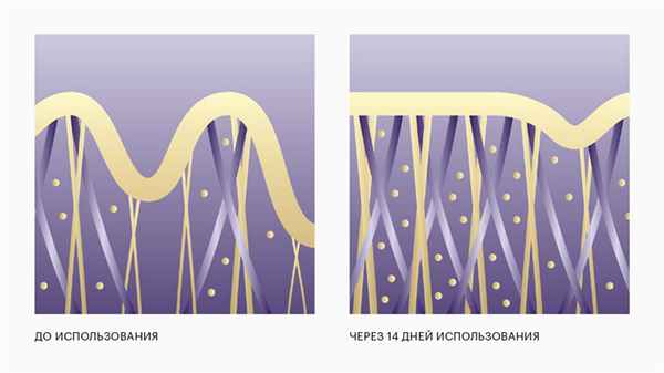 Кожа до коллагена и после