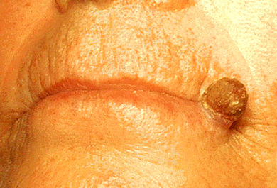 Описание этого изображения, также прокомментировано ниже