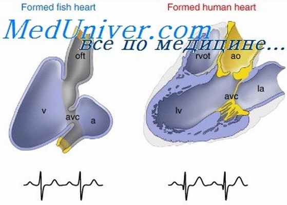 тетрада фалло