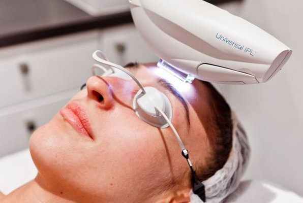 Лечение интенсивным импульсным светом