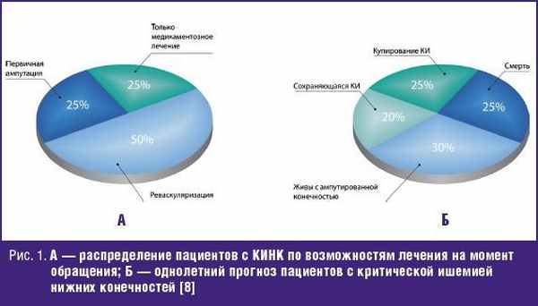 А — распределение пациентов с КИНК по возможностям лечения на момент обращения; Б — однолетний прогноз пациентов с критической ишемией нижних конечностей