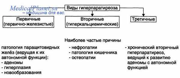 Виды гиперпаратиреоза