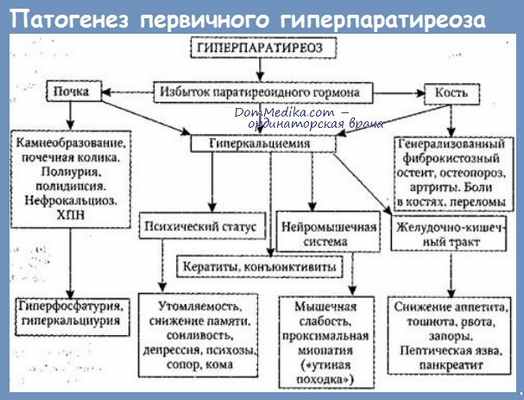 Патогенез первичного гиперпаратиреоза