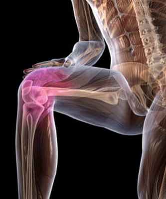 Деформирующий остеоартроз