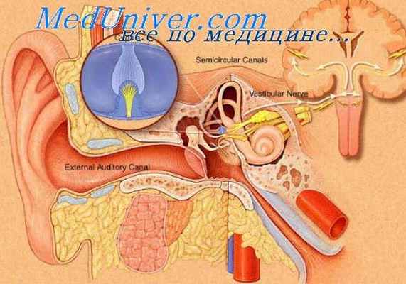 лабиринтит