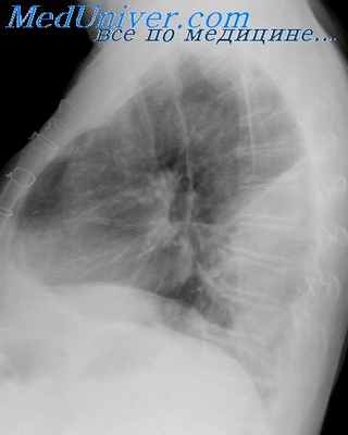 специфика анестезии