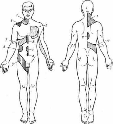 Участка Геда-Захарьина, где отмечают повышенную чувствительность или отраженная боль при заболеваниях внутренних органов; 