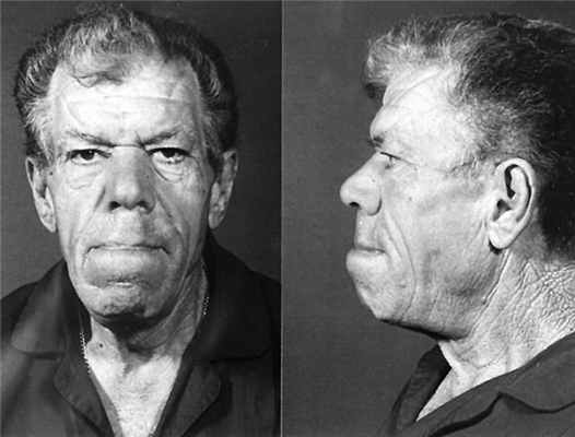 акромегалия