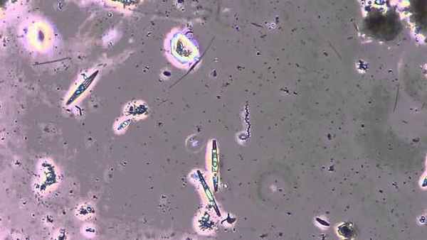 Спиралевидная бактерия и другие микроорганизмы