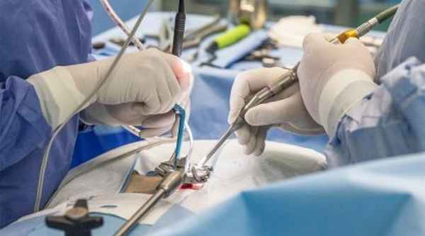 Лапароскопическое удаление грыжи позвоночника