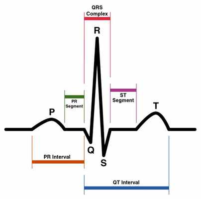 электрокардиограмма