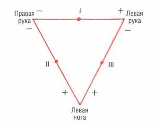 Треугольник Эйнтховена