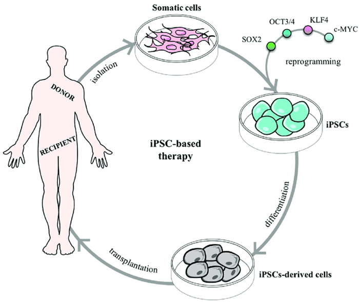 При помощи репрограммирования через факторы Яманаки соматические клетки донора становятся индуцированными стволовыми клетками