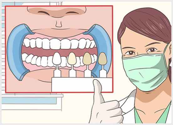 Лечение передних зубов