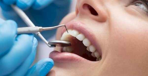 Кариес зубов диагностика