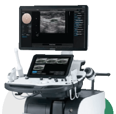 Стресс эхокардиография